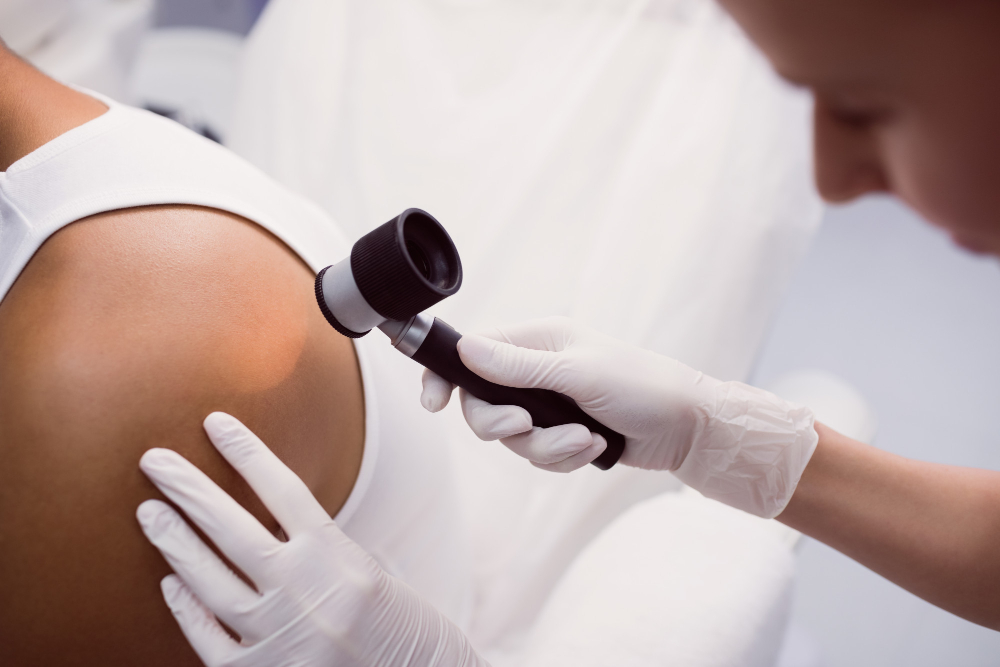 medicul dermatolog